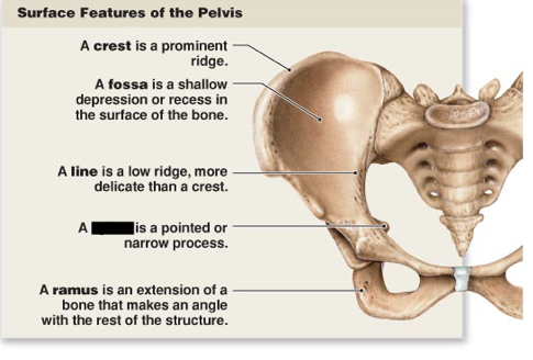 <p>this is the main surface features of the pelvis, what is this?</p>