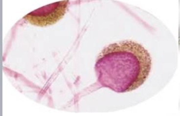 <p>Identify the fungi. Is asexual</p>