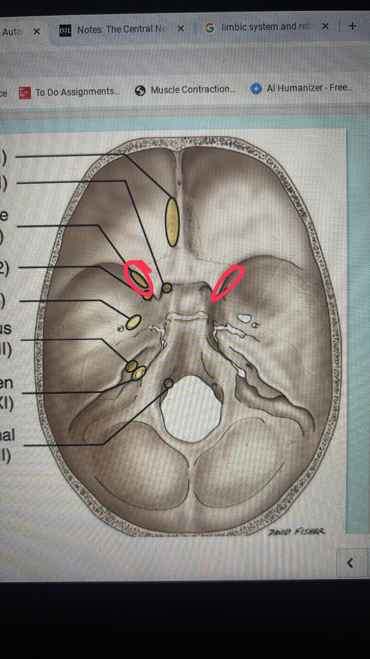 <p>cranial nerve III, IV, VI, and V1</p>