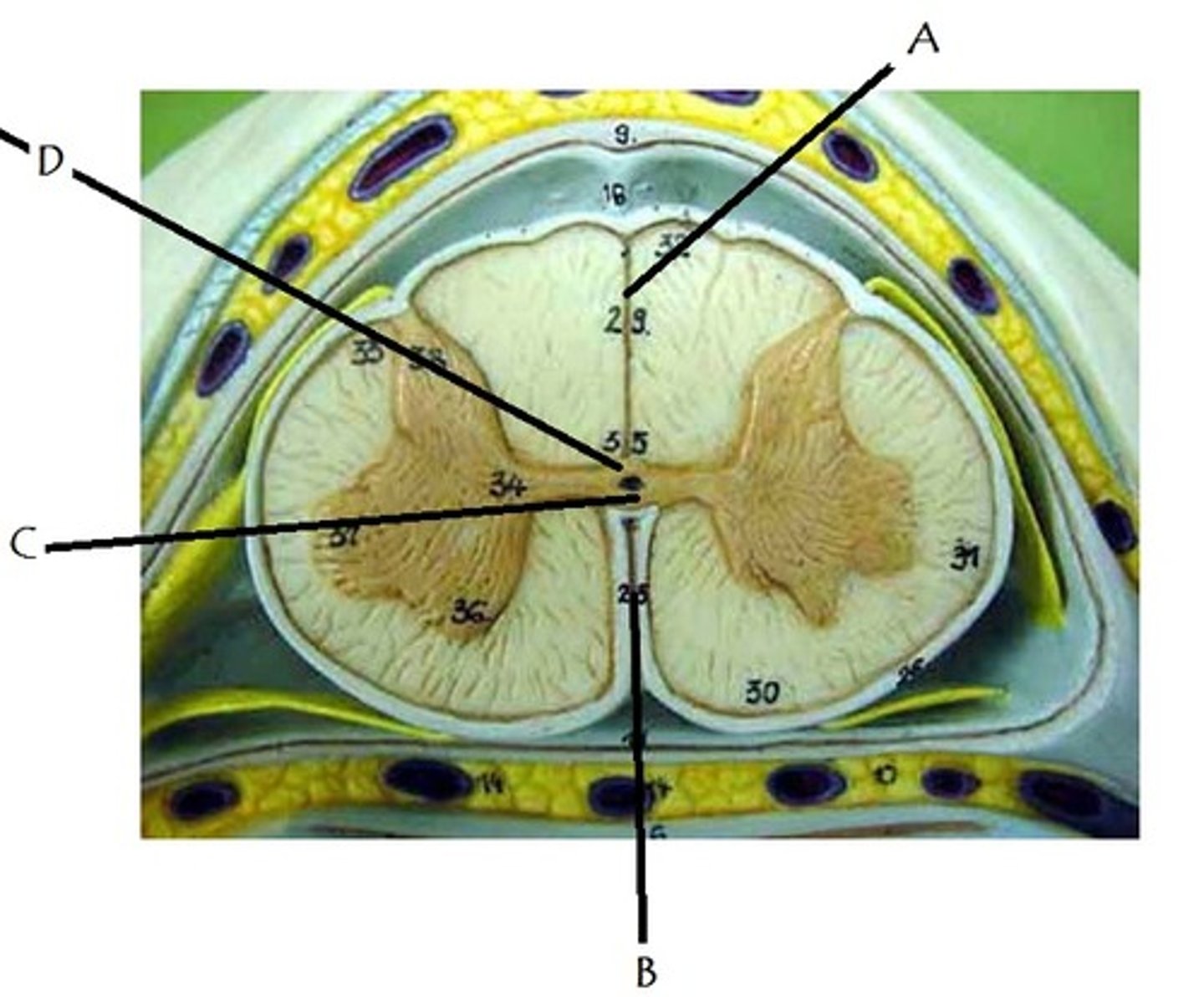 <p>Identify A</p>