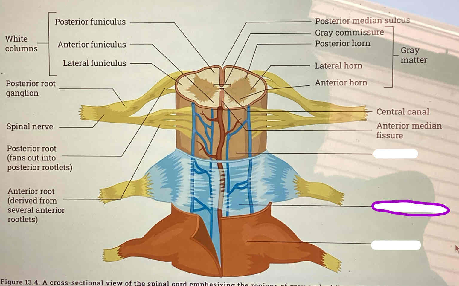 <p><strong><span>Arachnoid mater</span></strong></p>