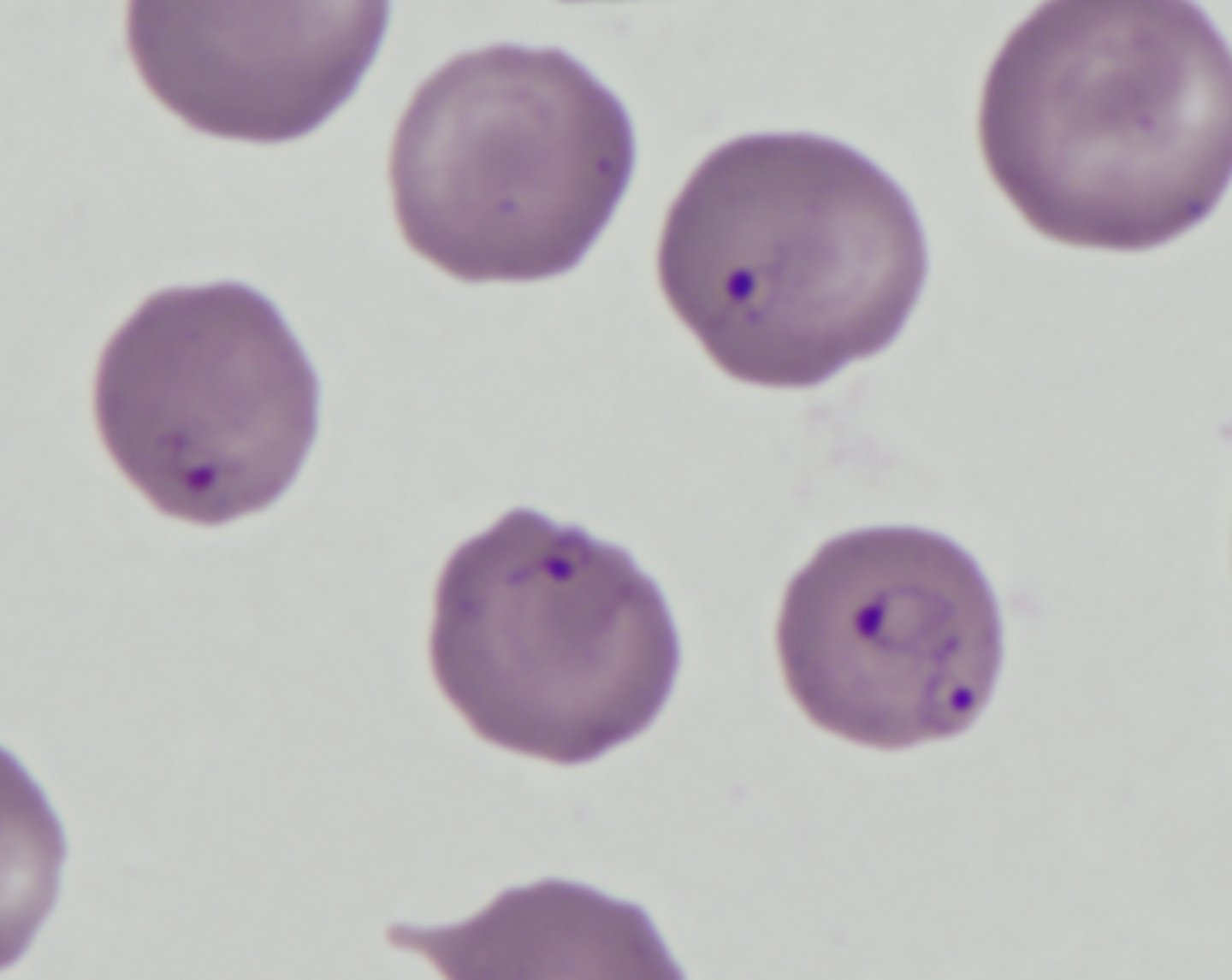 <p>ID the following parasites on blood smear (dog)</p><p>3-5um</p>
