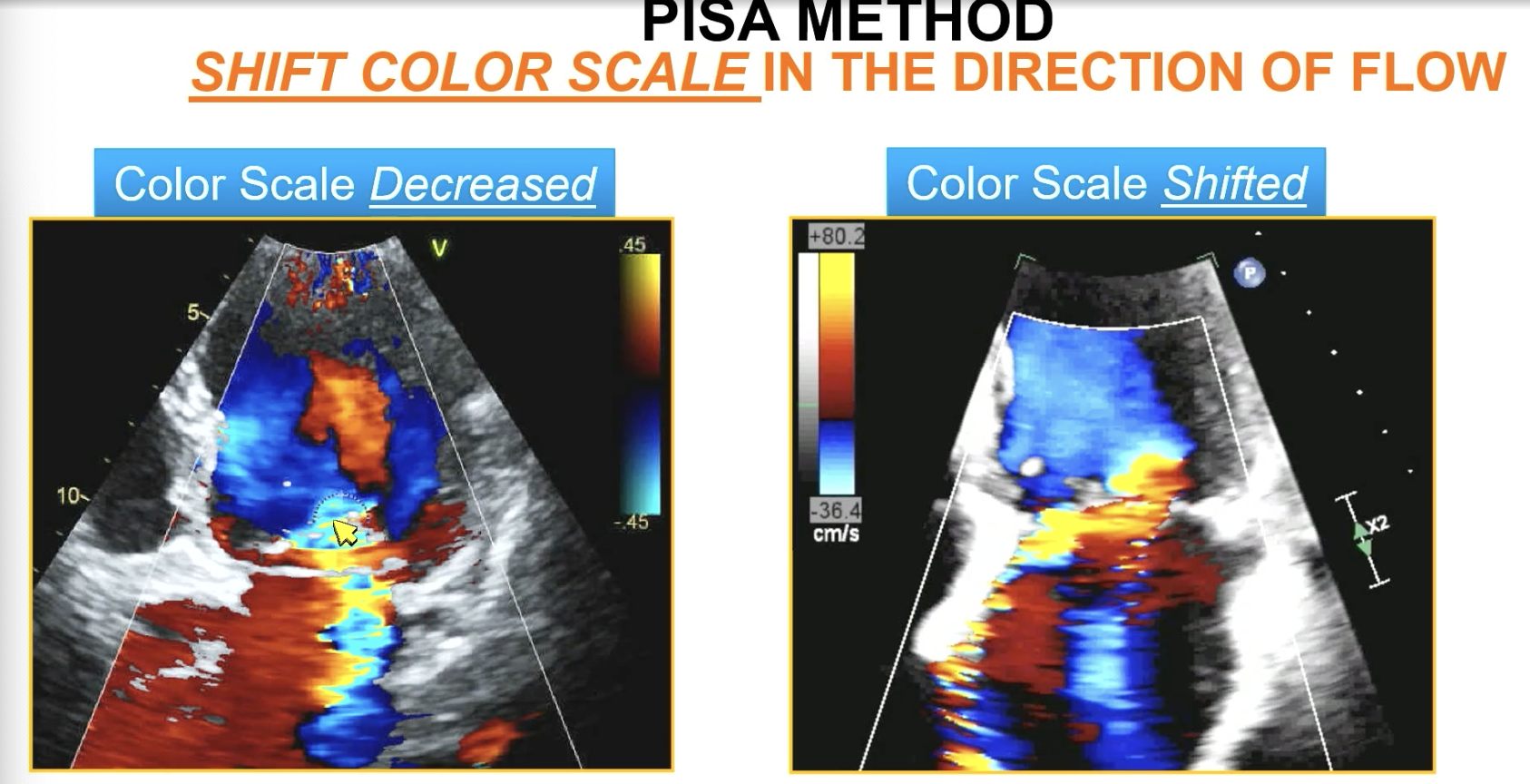 <p>the direction of flow (should be ~ 30-40 cm/s)</p><p></p><p>FYI used to “decrease” the color scale which is different. Not as good and end up with way more aliasing.</p>