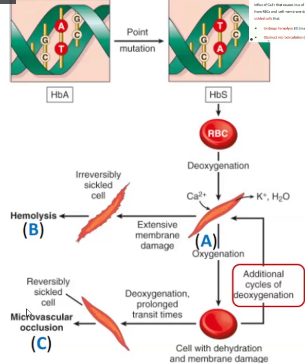 <ul><li><p>A hereditary disease caused by a point mutation is the beta-globin gene and results in abnormal Hb (HbS(sickle))</p><ul><li><p>Homozygous is severely affected</p></li><li><p>Cells undergo hemolysis or obstruct microcirculation</p></li></ul></li><li><p>Hemolytic anemia, jaundice, Ischemia</p></li><li><p><span style="color: red">Gel Electrophoresis </span></p></li></ul><p></p>