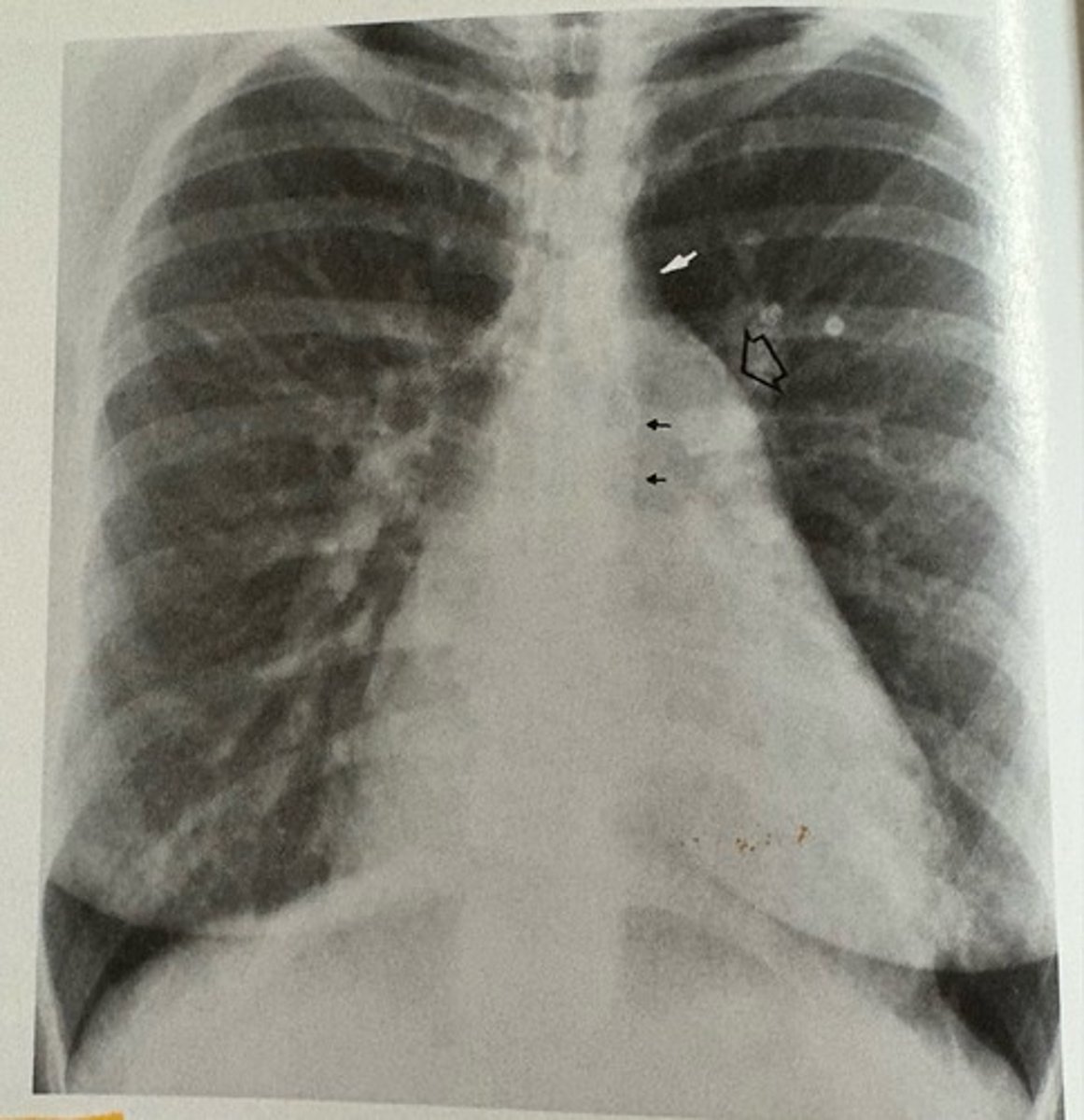 <p>what pathology is present?</p>