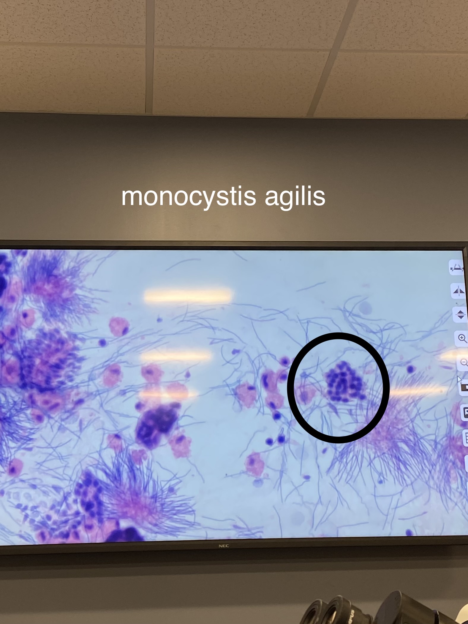 <p>-parasitize earthworms </p>