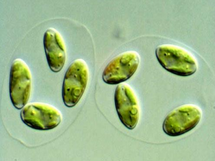 <p>Células independientes agregadas en una vaina mucilaginosa.</p>