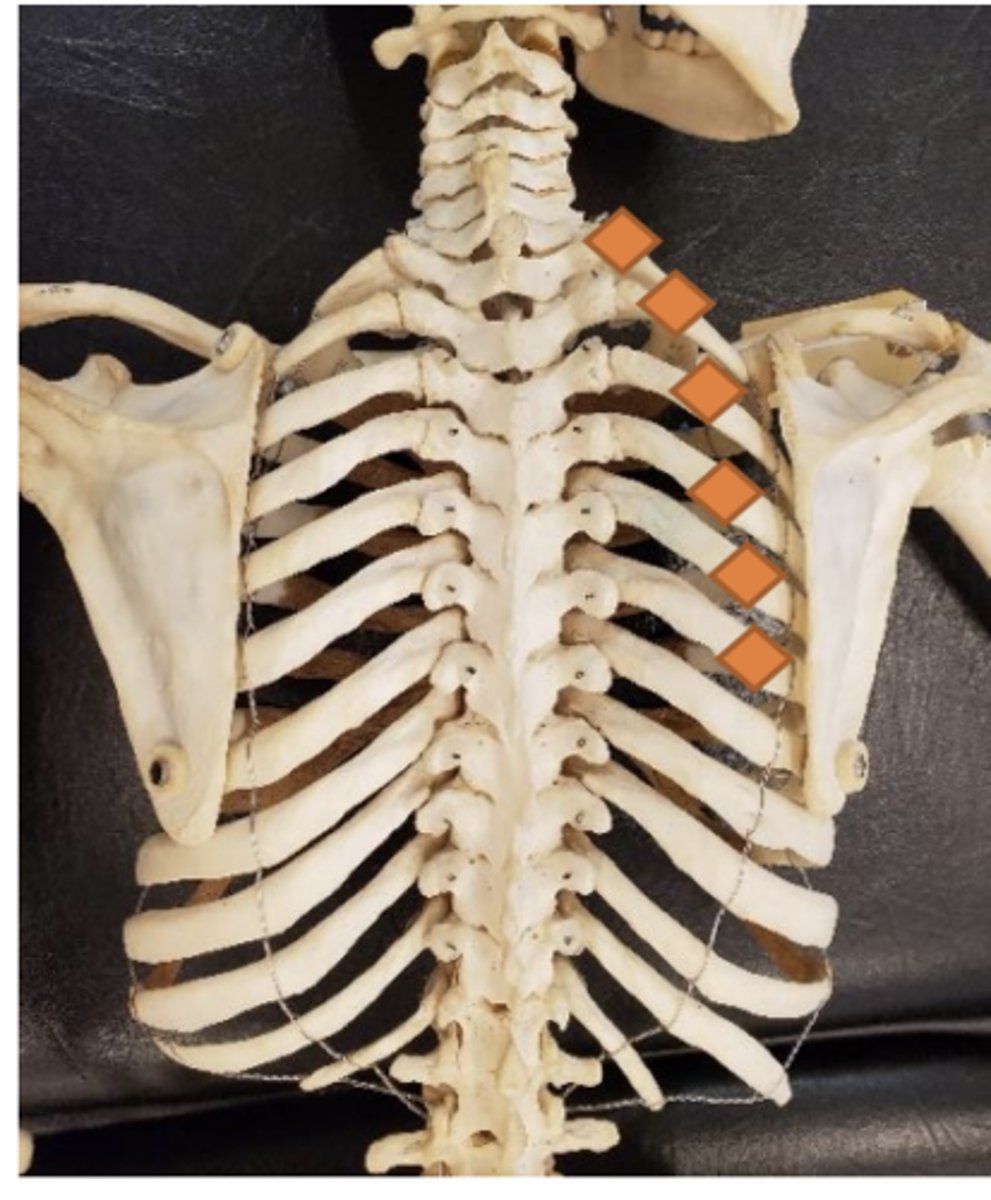 <p>posterosuperior aspect of appropriate rib</p>