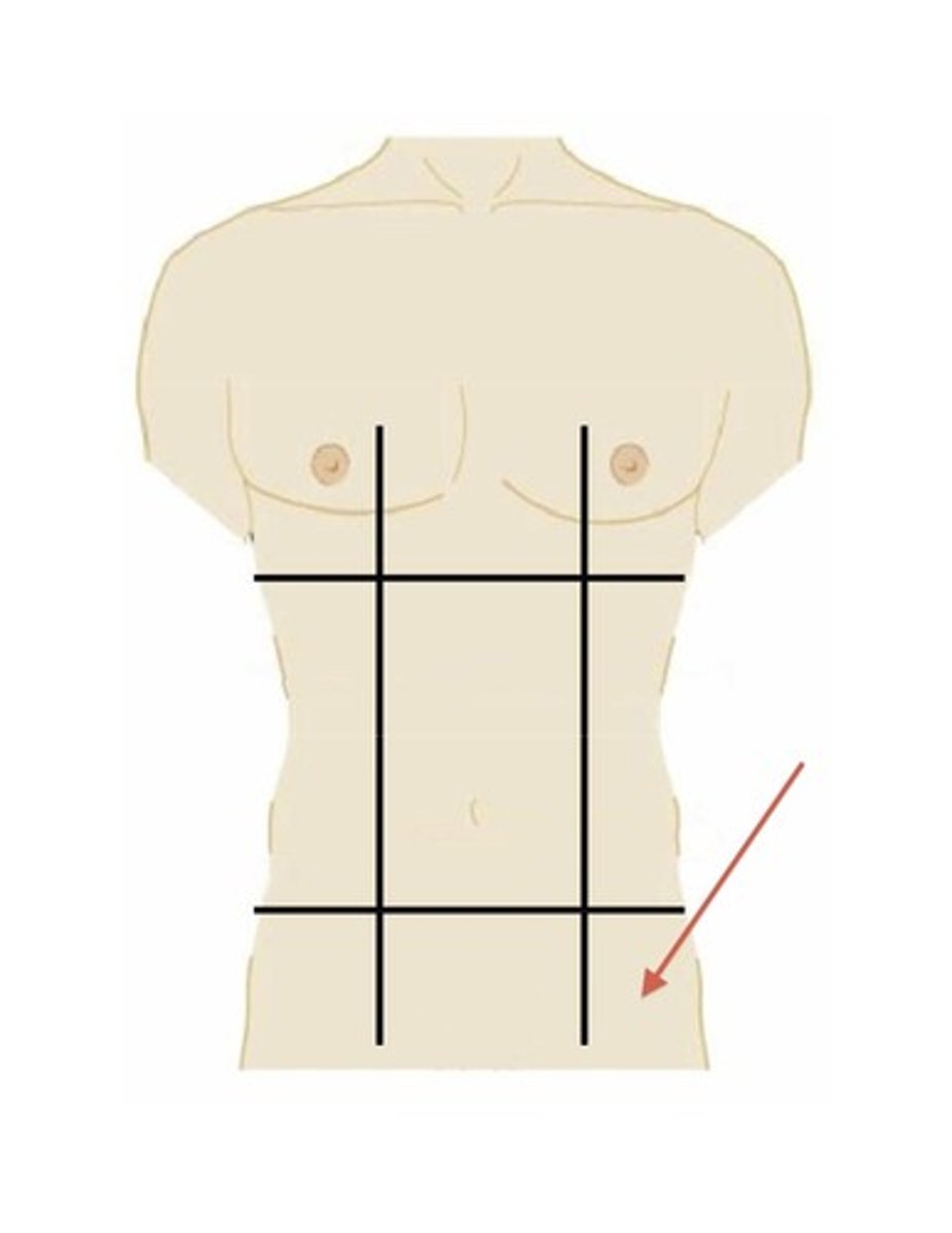 <p>lower left region</p>