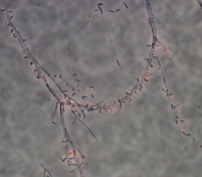 <p>Thricophyton rubrum</p>