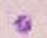 <p>what is this blood cell?</p><img src="https://knowt-user-attachments.s3.amazonaws.com/440b20e4-d645-41b7-86ba-edfe555970e2.png" data-width="75%" data-align="center"><p></p>