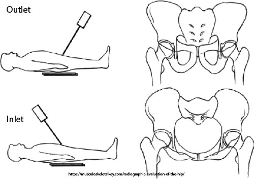 <p>What do inlet and outlet views evaluate?</p>