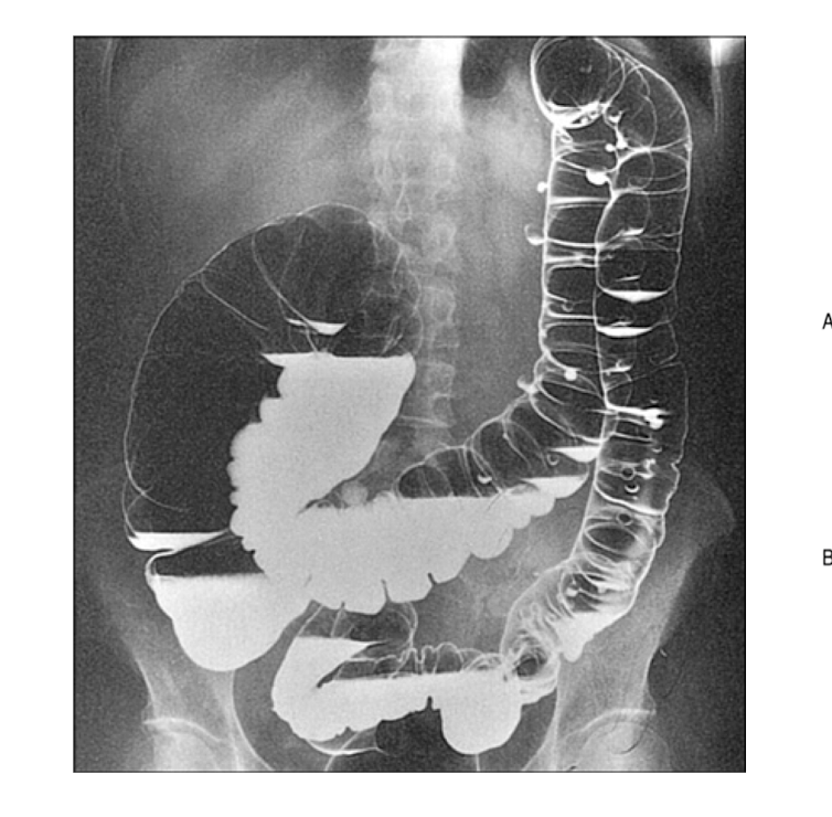 <p>What is shown on the image?</p>