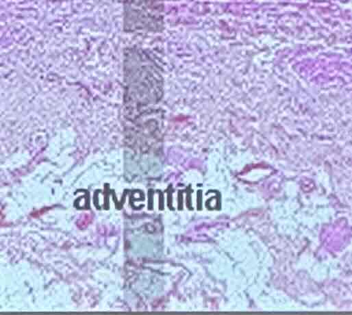 <p>fibrostatic outer layer</p>