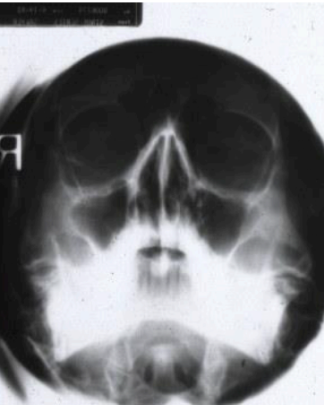 <p>purpose of this radiograph </p>