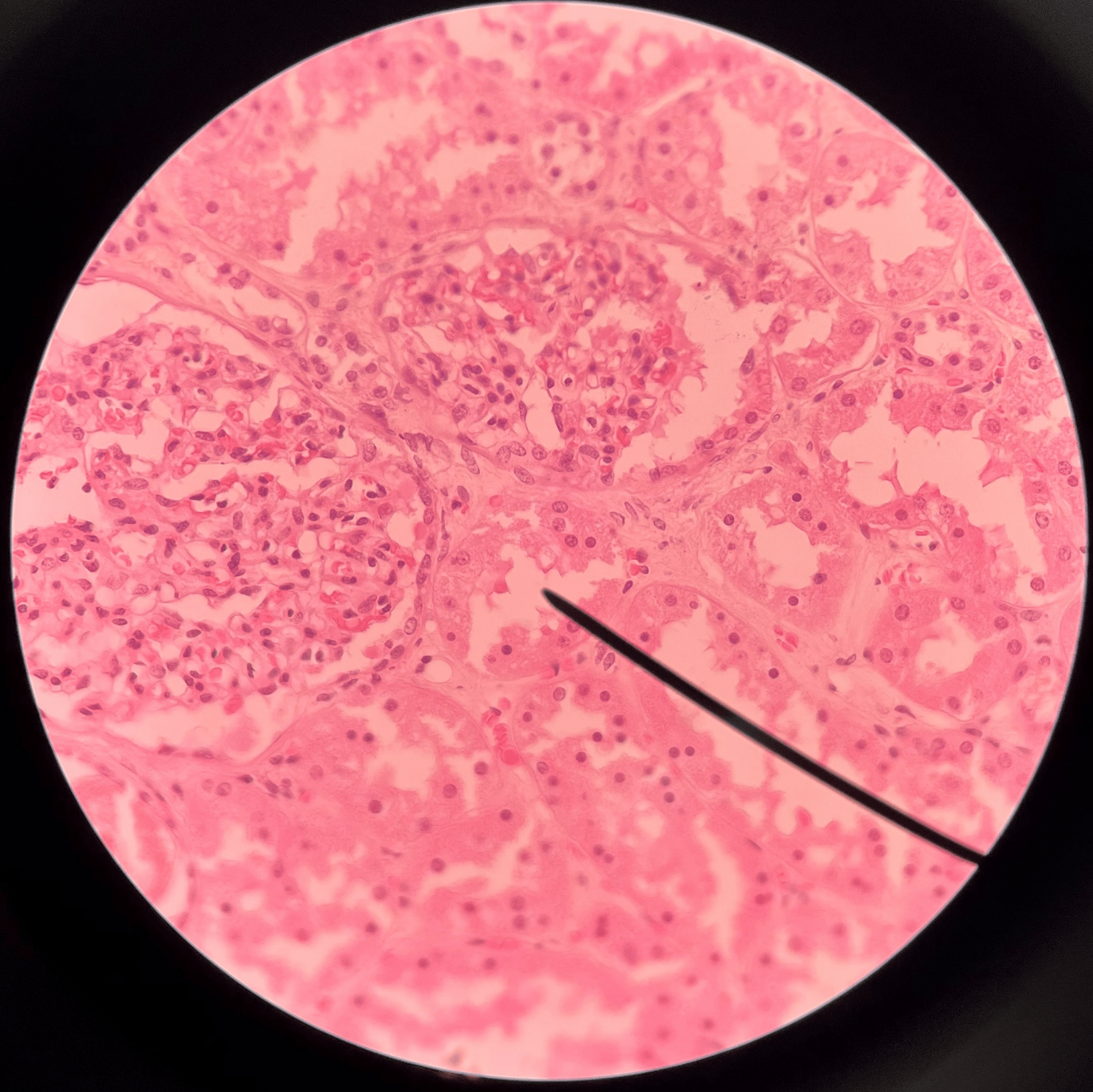 • Slide histology of the nephron.

• Part of a nephron.

• Modifies glomerular filtrate by reabsorption and secretion of water and ions.

• Divided into the proximal convoluted tubule, loop of Henle, and distal convoluted tubule.