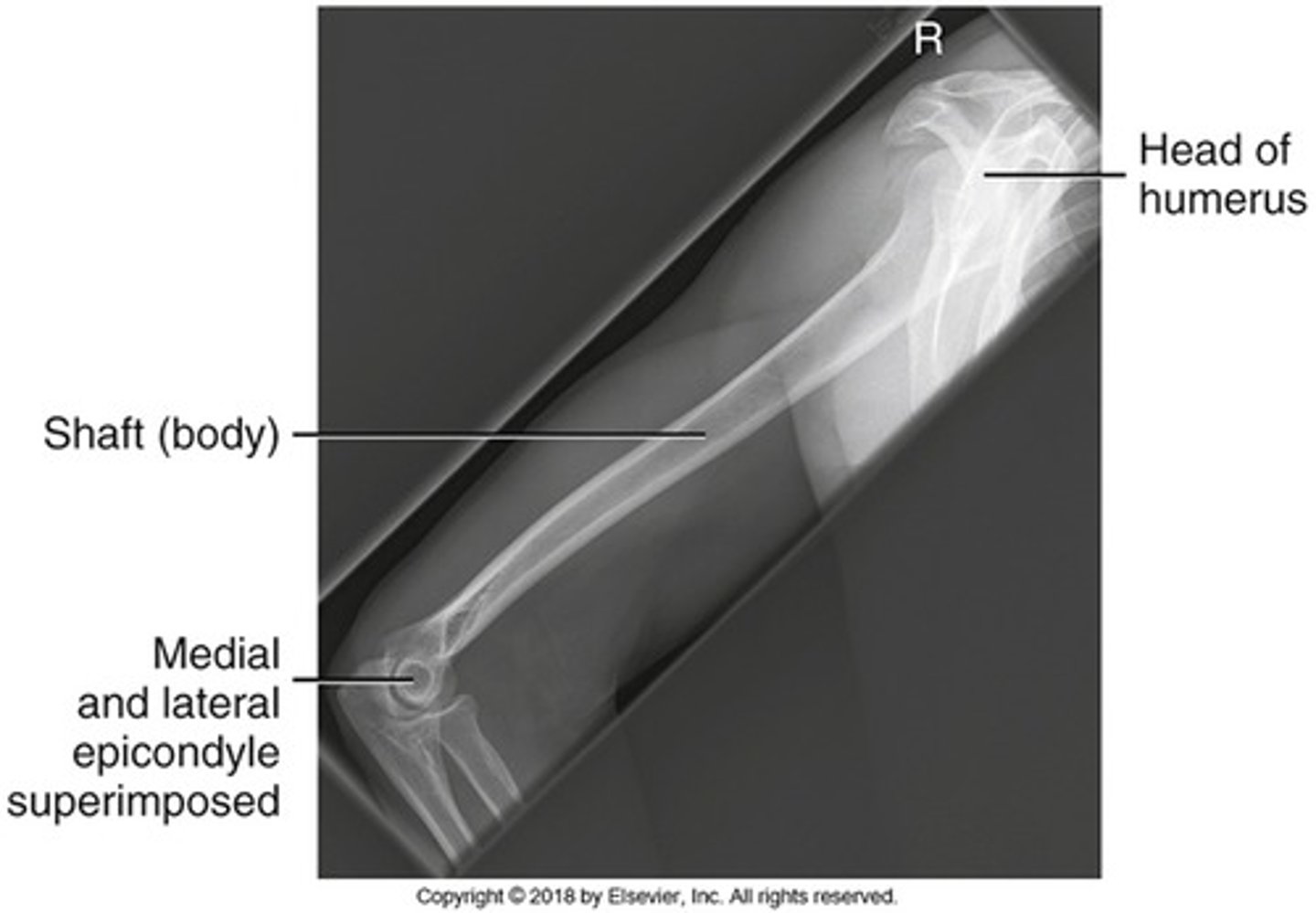 <p>- elbow and shoulder</p><p>- epicondyles</p><p>- humeral head</p>