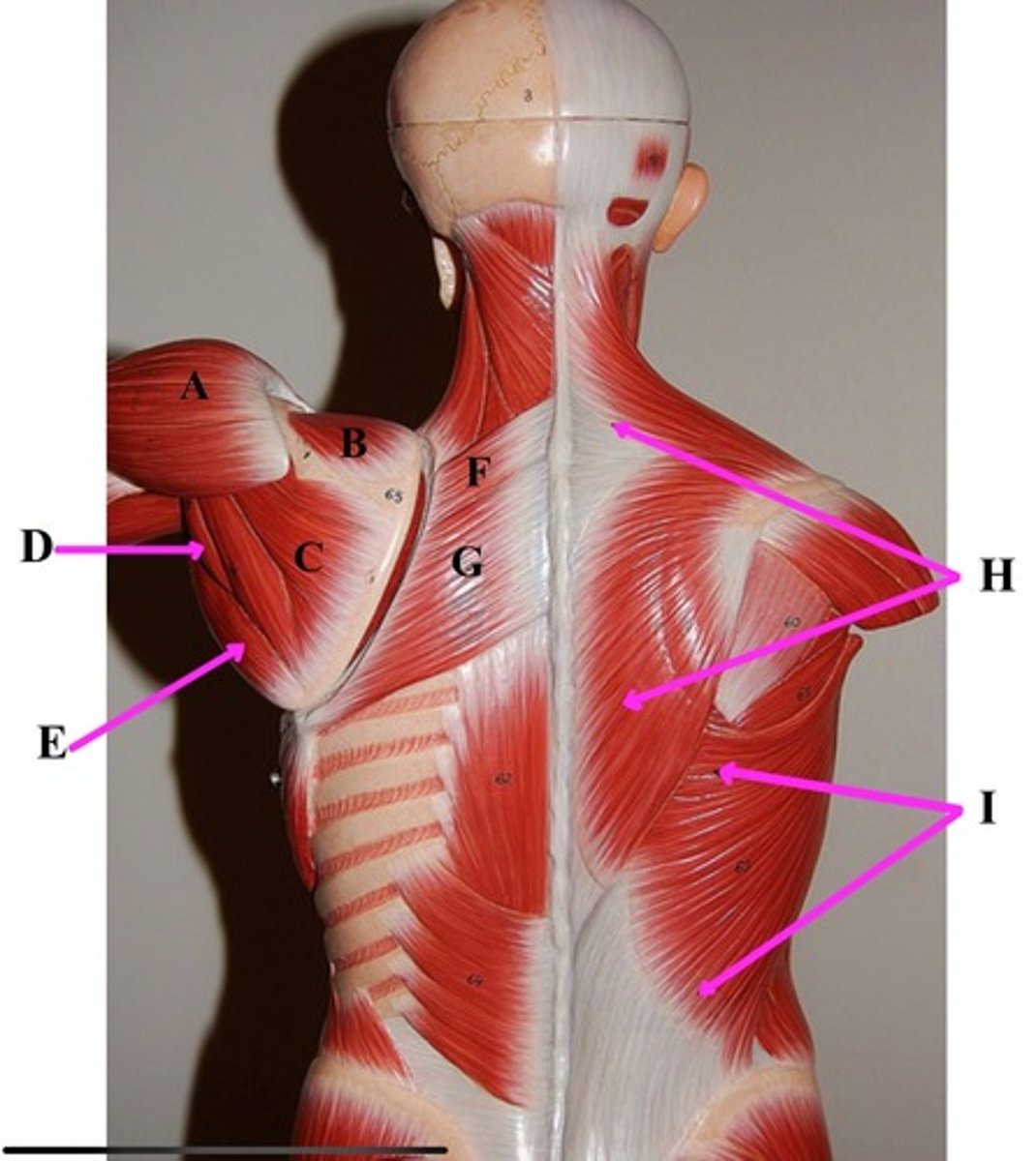 <p>G-</p>