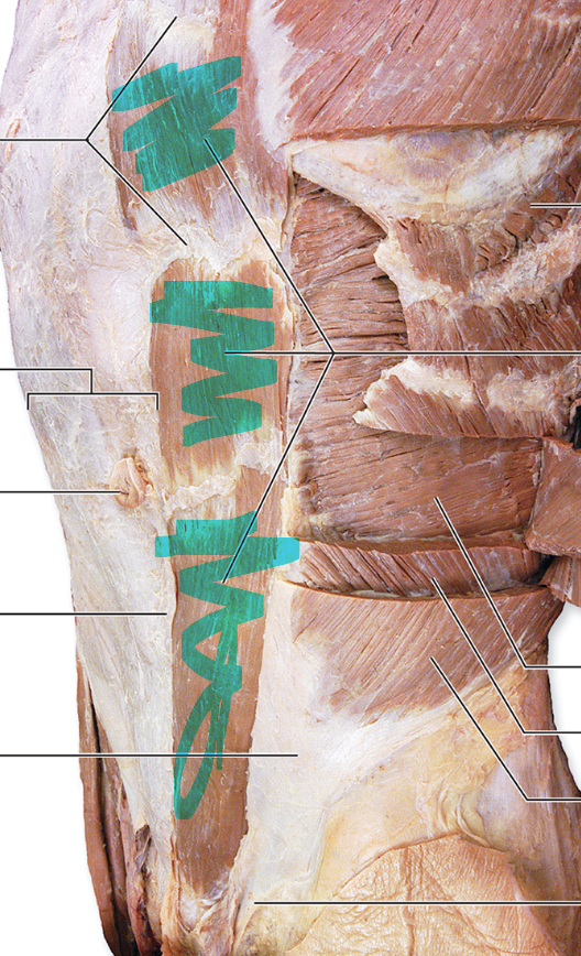 <p>Rectus Abdominis</p>