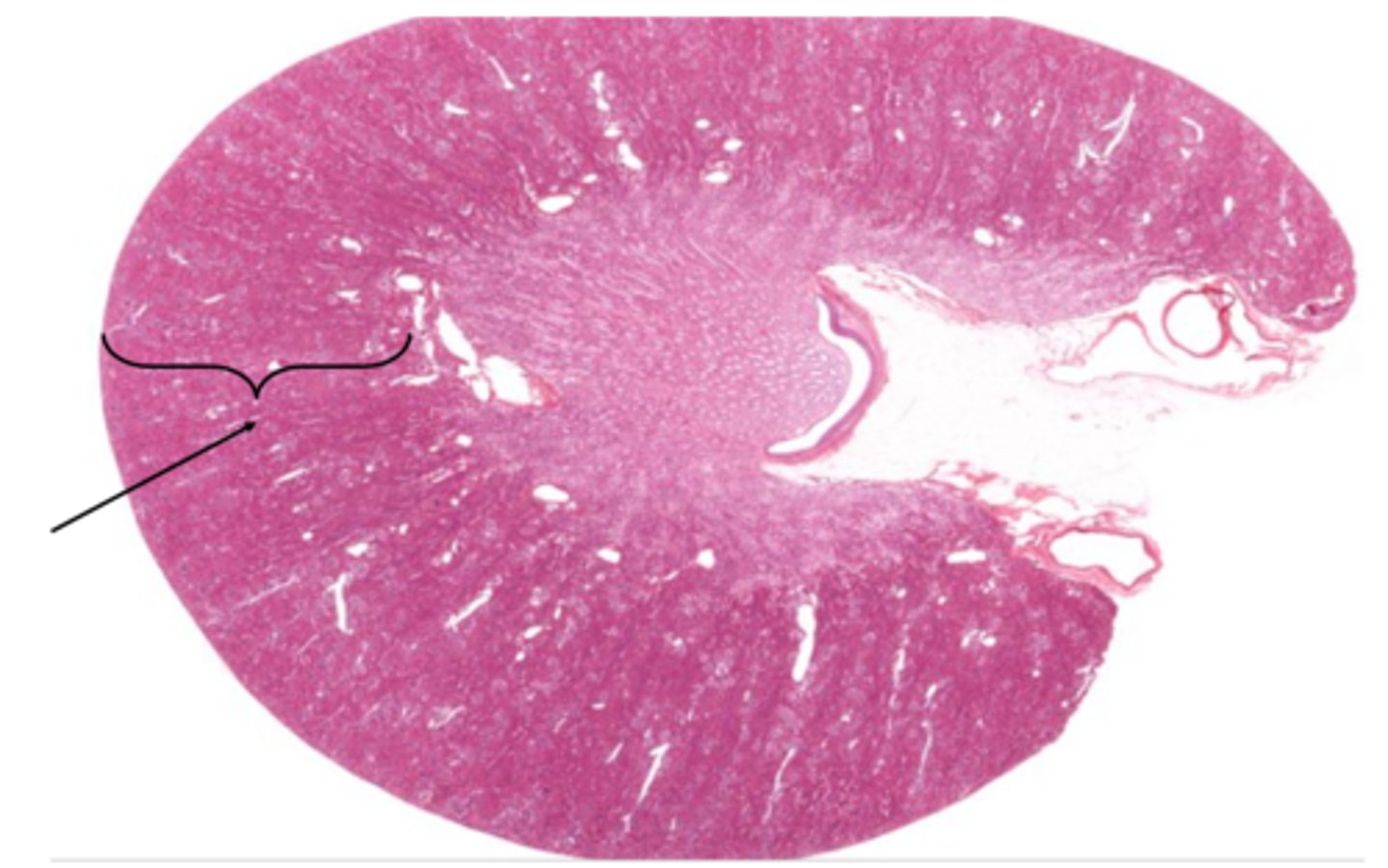 <p>Identify the structure on the kidney</p>