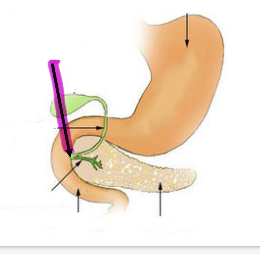 <p>Wat is hier aangeduid</p>