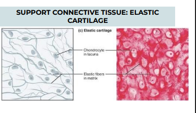 <p>TISSUE: SUPPORT CONNECTIVE TISSUE: ELASTIC CARTILAGE</p>