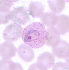 <p>Dr. Vicente Y. Belizario Jr.</p>