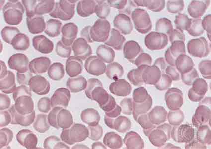 <p>Erythrocytes </p>