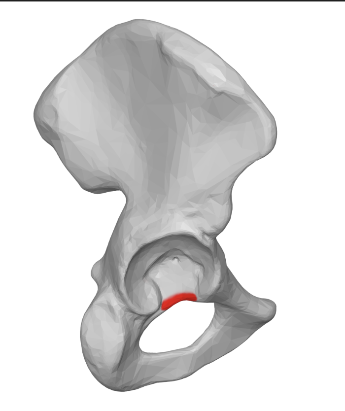 <p>the gap in the bottom edge of the acetabular fossa</p>
