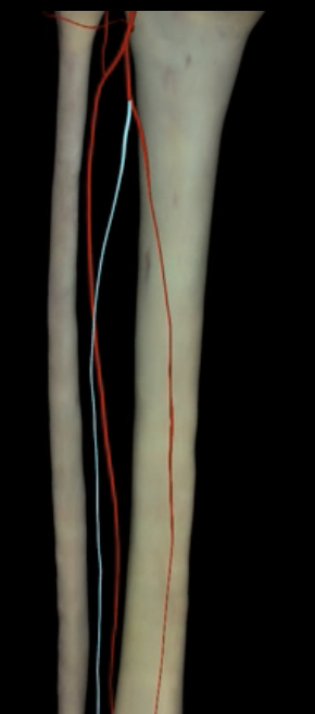 <p>What is highlighted in blue?</p>