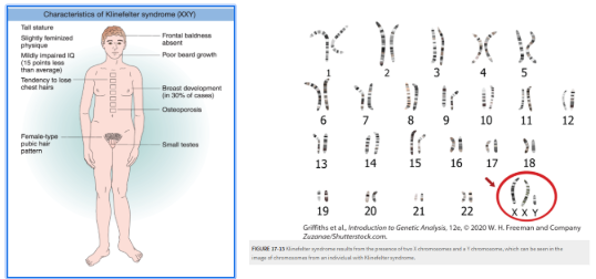 <ul><li><p><span>There are several examples of viable human trisomies. Several types of sex-chromosome trisomics can live to adulthood, whereas there are only 3 autosomal trisomics that won’t die in utero.</span></p></li><li><p><span>The combination XXY results in Klinefelter syndrome. </span></p></li><li><p><span>Phenotypes:</span></p><ul><li><p><span>Males who have a more feminised, lanky build</span></p></li><li><p><span>A female type pubic hair pattern</span></p></li><li><p><span>Small testes</span></p></li><li><p><span>Risk of osteoporosis</span></p></li><li><p><span>Absent frontal baldness</span></p></li><li><p><span>Mildly impaired IQ</span></p></li><li><p><span>Sterile</span></p></li></ul></li></ul><p></p>