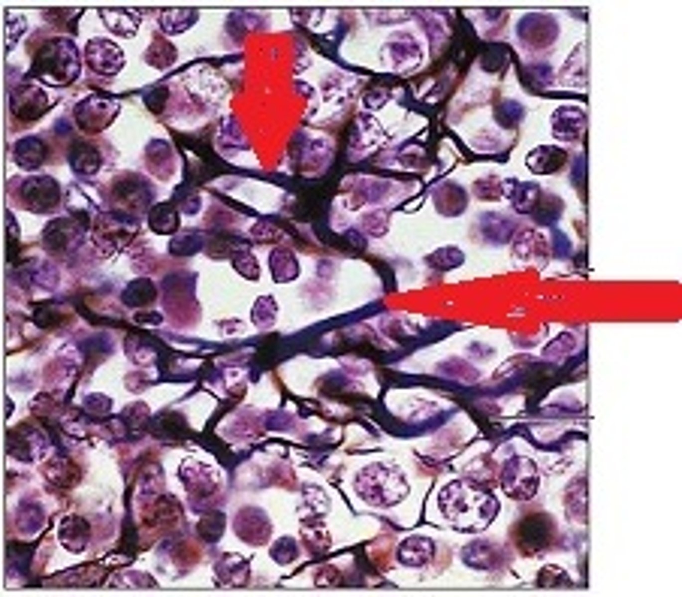 <p>very thin, highly branched collagenous fibers that give the matrix of certain connective tissues a net-like appearance</p>