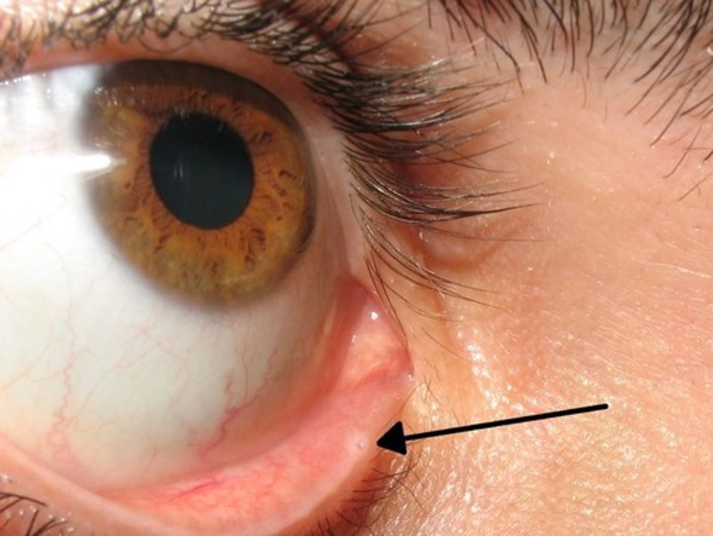 <p>Tiny openings of the tear ducts.</p>