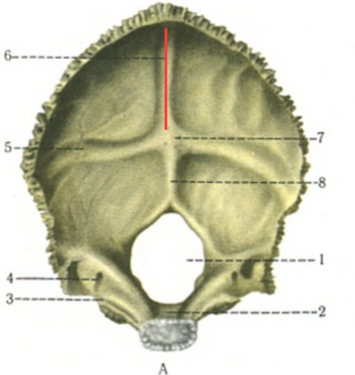 <p>for sagittal sinus</p>