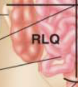 <p>What does the right lower abdominal quadrant contain?</p>