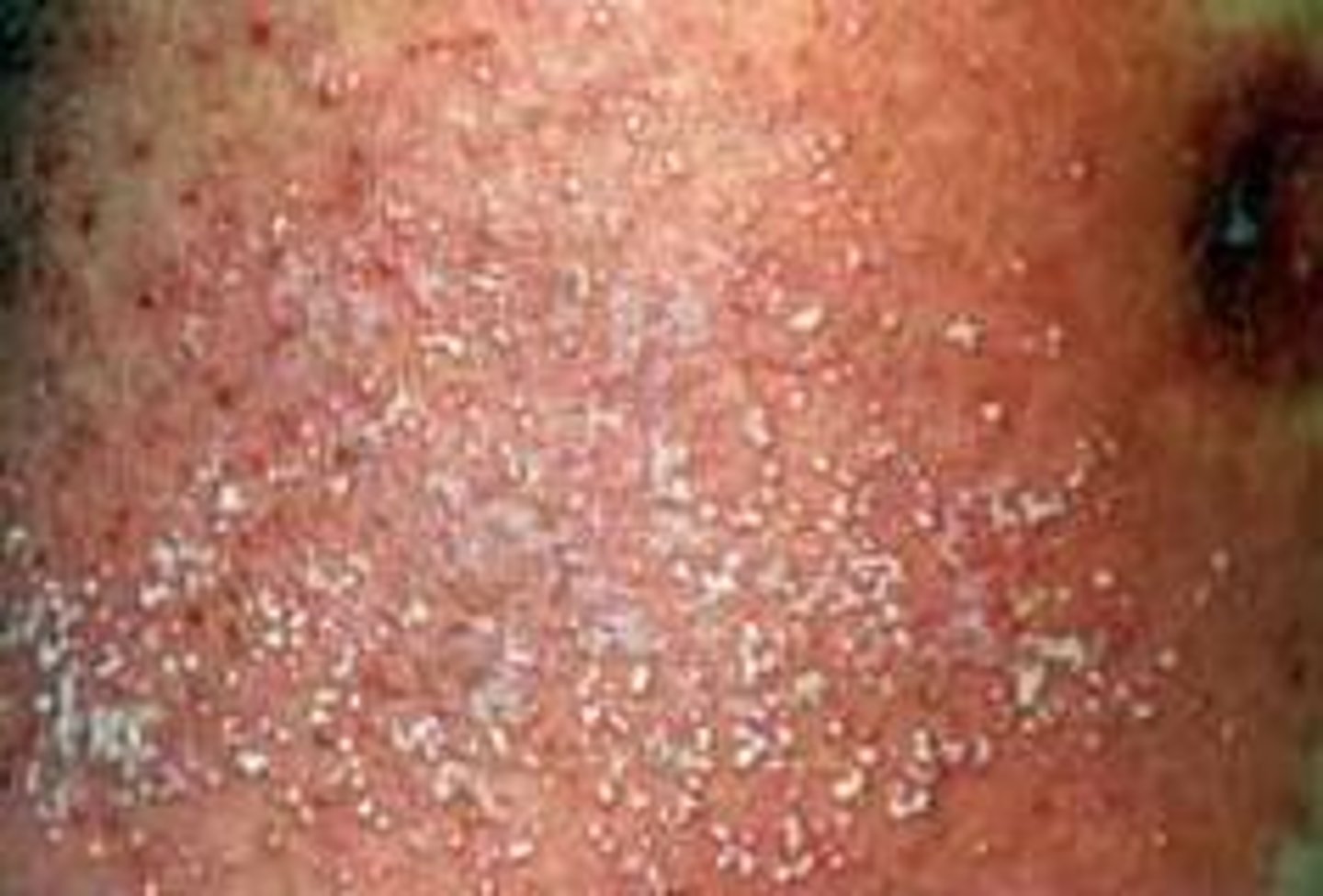 <p>diagnose this image</p>