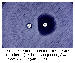 <ul><li><p>Inducible clindamycin resistance</p></li><li><p>Macrolide resistance in Staph and Strep are conferred by the erm gene which results in resistance to erythromycin and either inducible or constitutive resistance to clindamycin</p></li></ul>