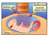 The waves are partially reflected when they meet a boundary between two materials and the time taken for the reflected waves to reach a detector can be used to determine how far away the boundary is