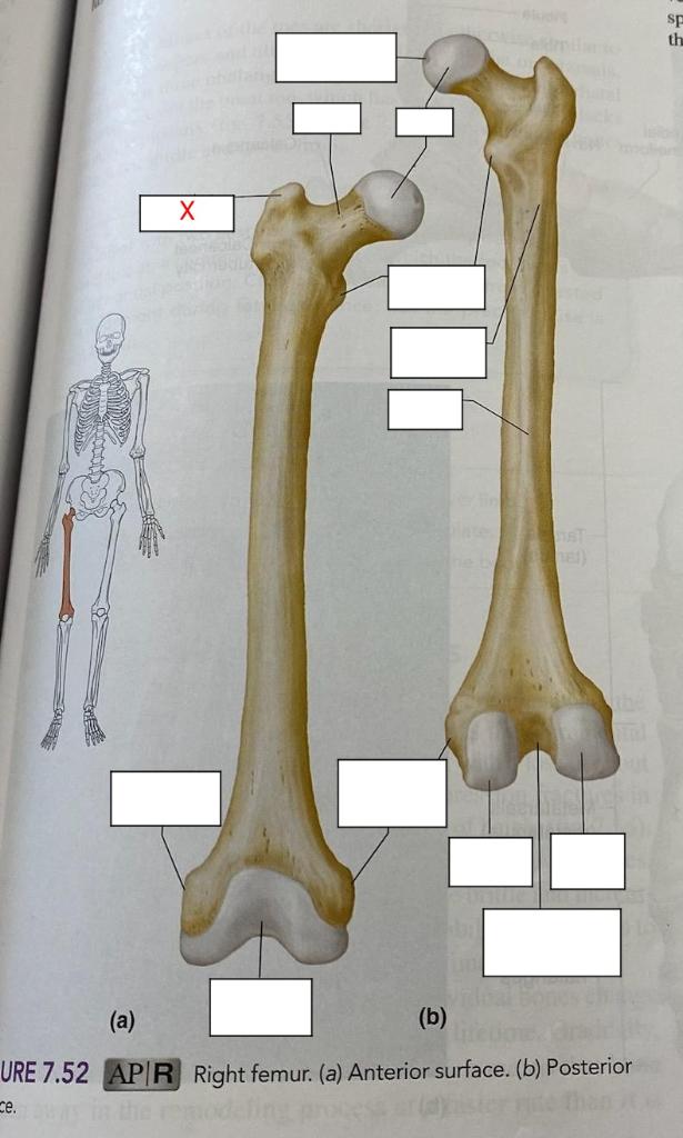 prominent for attachment of large buttocks muscles