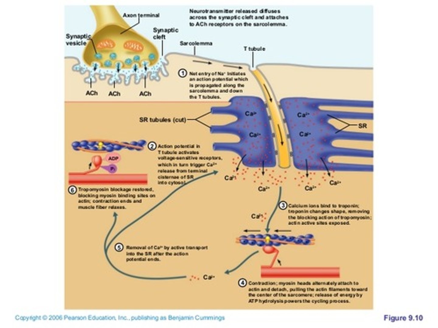 <p>1) Motor neuron releases acetylcholine into the neuromuscular junction and causes the depolarization of the sarcolemma.</p><p>2) Depolarization spreads down the sarcolemma to the T-tubules, triggering the release of Ca2+ ions.</p><p>3) Ca2+ binds to troponin, causing a shift in tropomyosin and exposure of the myosin-binding site on the actin filament.</p><p>4) Shortening of the sarcomere occurs as the myosin head binds to the exposed sites of actin, forming a cross-bridge and pulling the actin filament along the thick filament, resulting in contraction.</p><p>5) Muscle relaxes when acetylcholine is degraded by acetylcholine esterase and the allowing Ca2+ is brought back into the SR. ATP binds to myosin head, allowing it to relax from actin.</p>