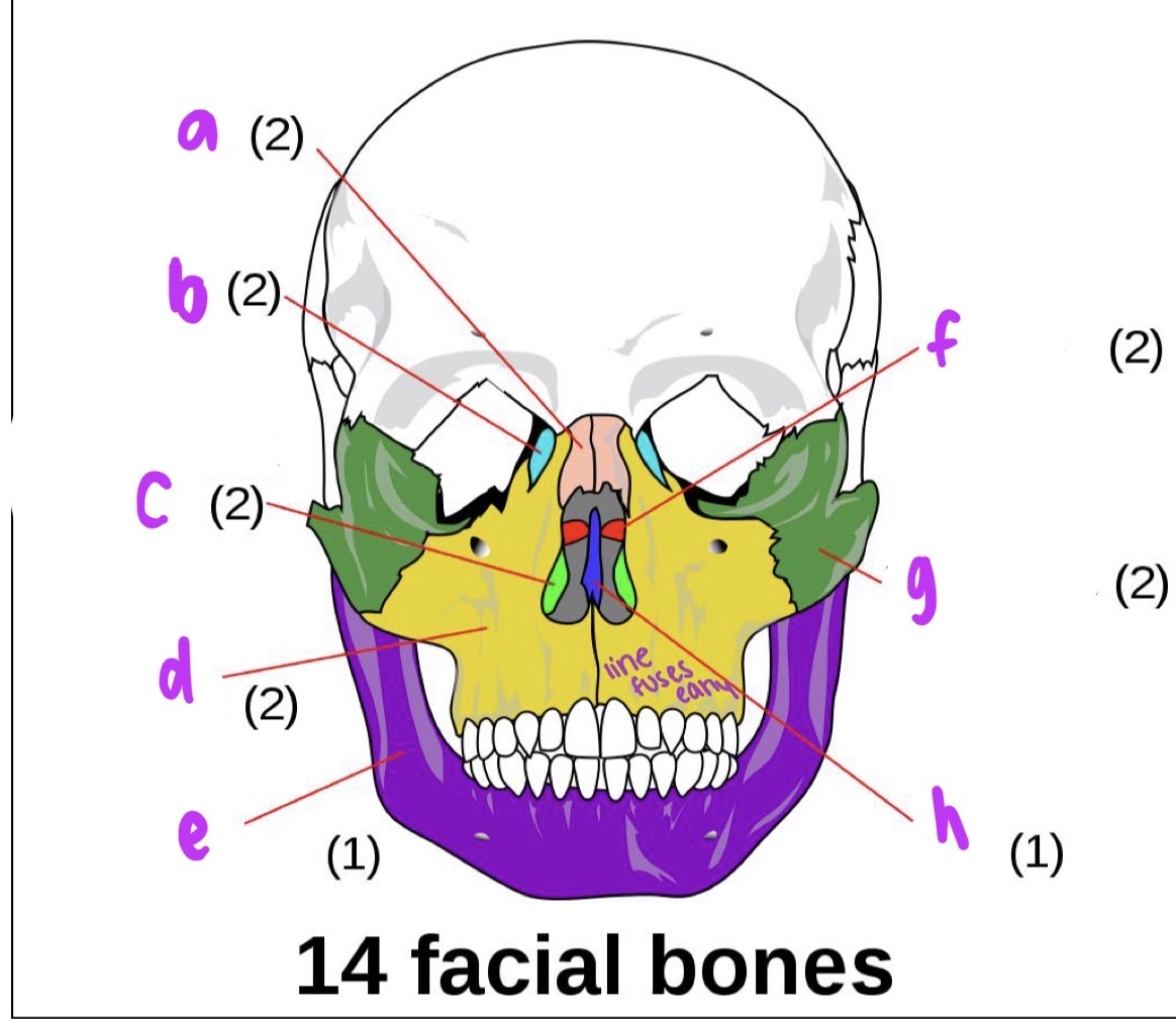 <p>Label facial bones </p>