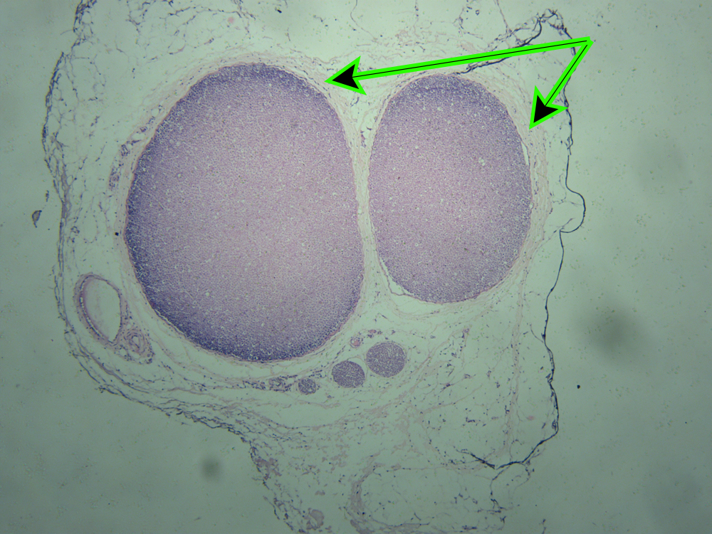 <p><em>[Quiz - Lab 2.1 (Neurophysiology and EEG): Check Your Understanding]</em></p><p><strong>Identify the connective tissue sheath at the end of <u>both</u> pointers:</strong></p><p>a. perineurium</p><p>b. epineurium</p><p>c. fassicle</p><p>d. endoneurium</p>