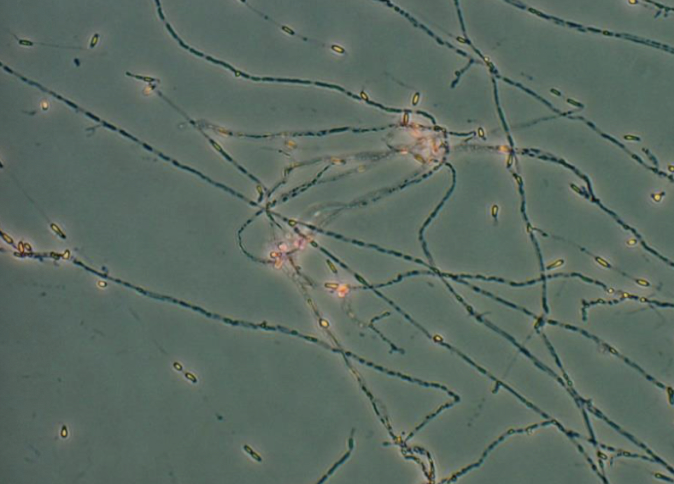 <p>Malbranchea spp.</p>