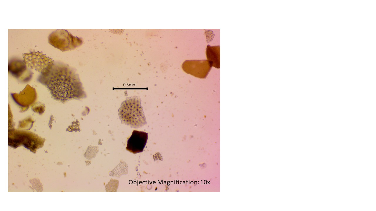 <p><span>which supergroup do Cercozoa, Radiolarians and Foraminiferans belong to</span></p>