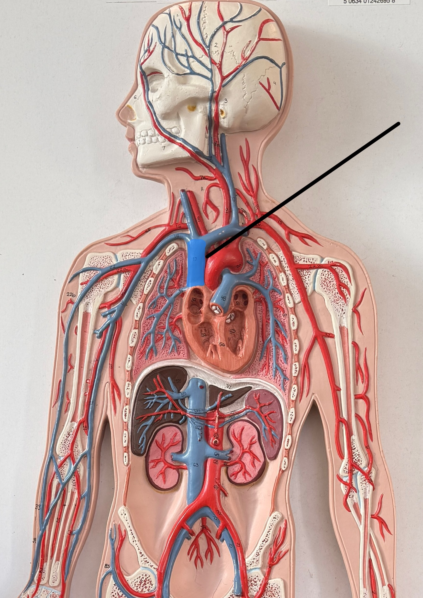 <p>Name this vein.</p>