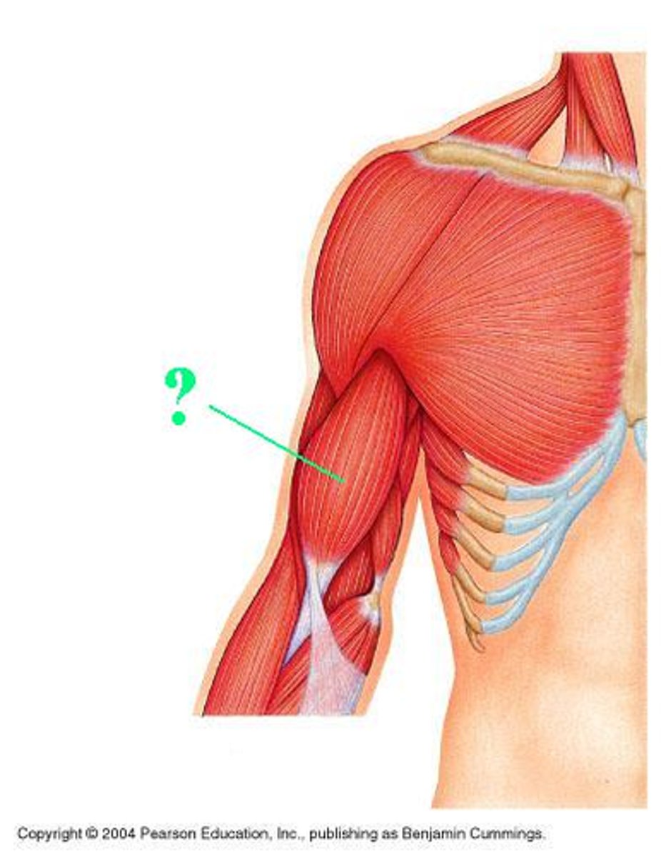<p>Identify the indicated muscle</p>