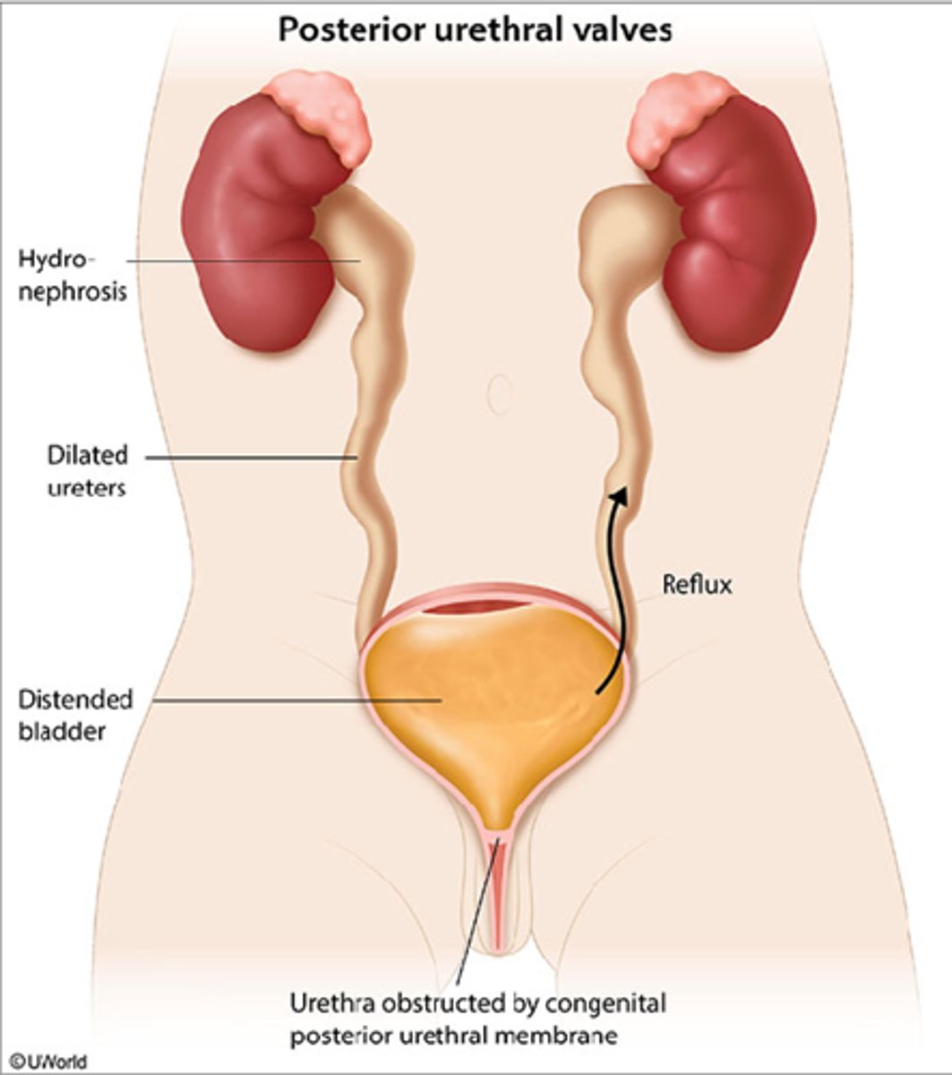 <p>With posterior urethral valves, you may see an overly distended (enlarged) ___ with ___ hydroureter and hydronephrosis on ultrasound.</p>