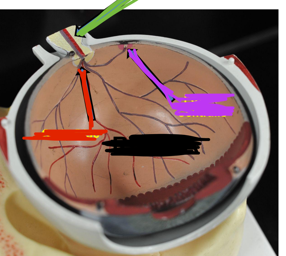 <p>Black labels what part of the eye (Cross-Section)</p>