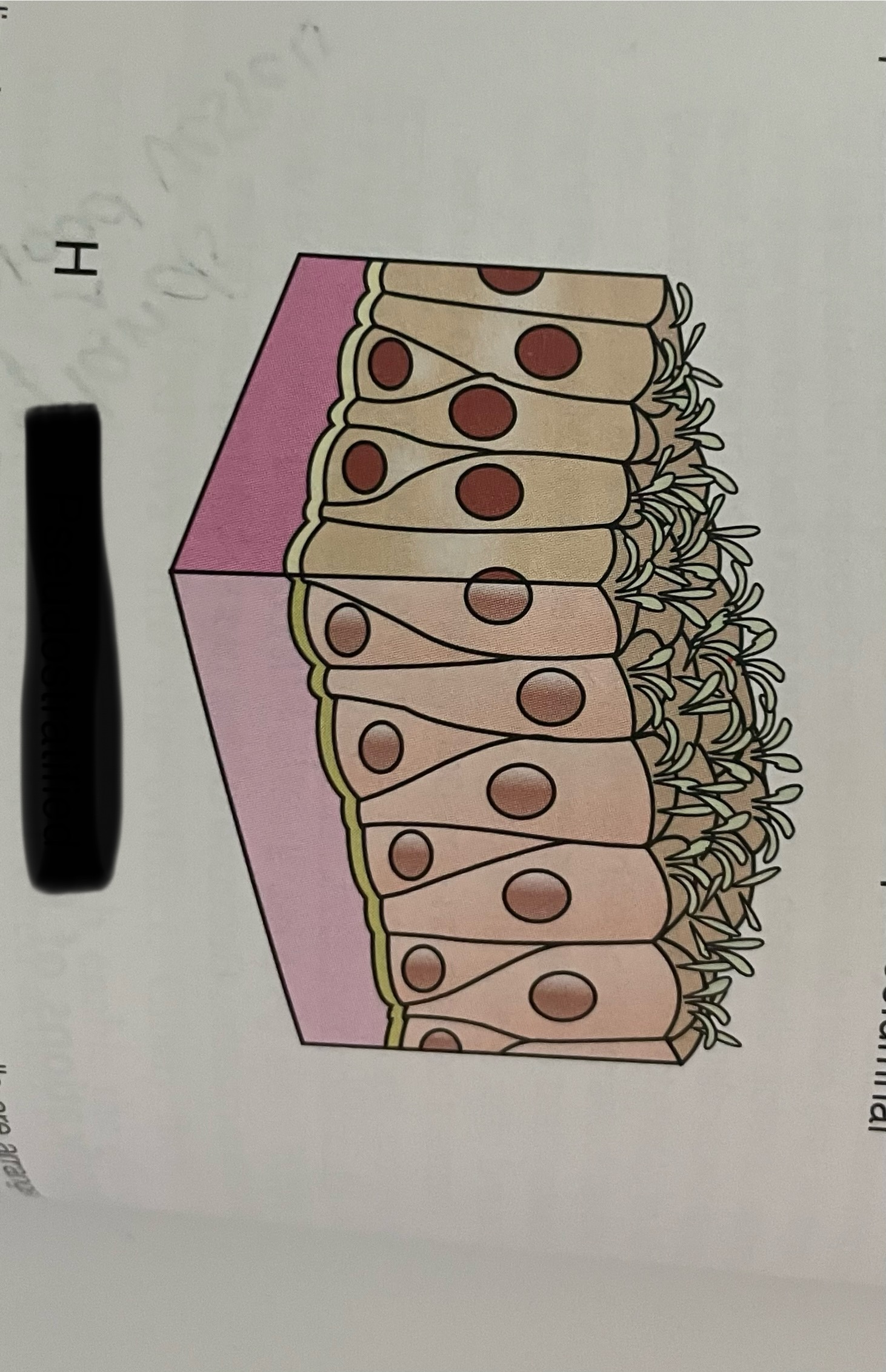 <p>what type of layering is this?</p>