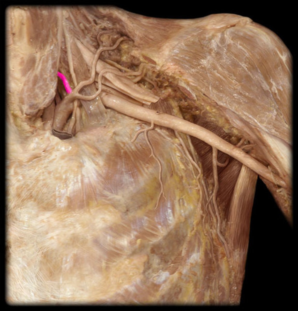 <p>Name the Artery</p>